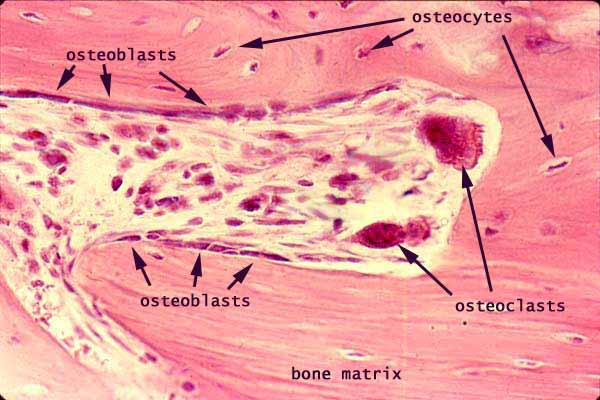 Un diagrama con osteoblastos y osteoclastos dentro del hueso
